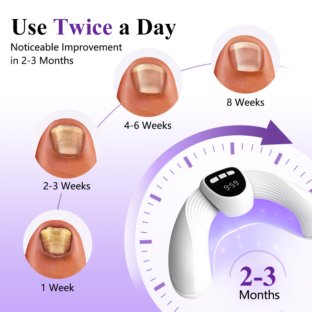 Dispositivo Laser 2-in-1 per M - Industrial Laser Removal recensione e prezzo